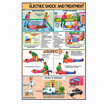 Electric Shock Treatment Chart